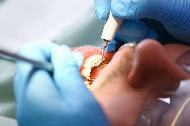 Best Emergency Dental Surgery in Woodhaven, MI