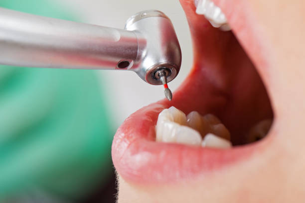 Best Emergency Treatment for Toothache in Woodhaven, MI